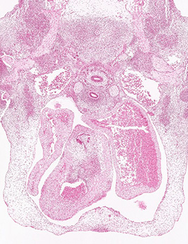 A histology section of a human embryo