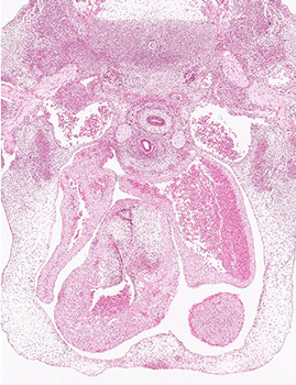 A histology section of a human embryo