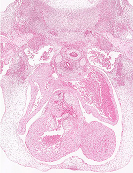 A histology section of a human embryo