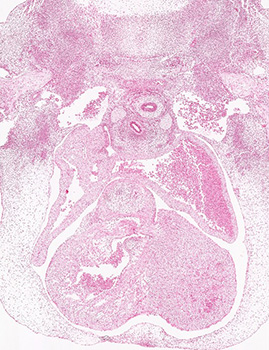 A histology section of a human embryo