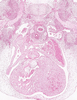 A histology section of a human embryo
