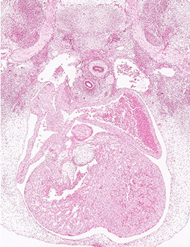 A histology section of a human embryo