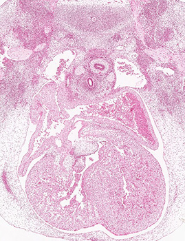 A histology section of a human embryo