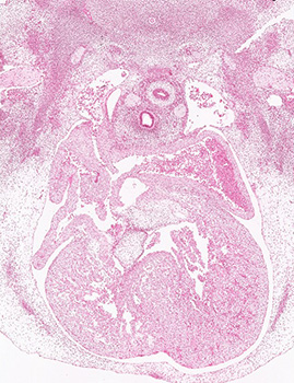 A histology section of a human embryo