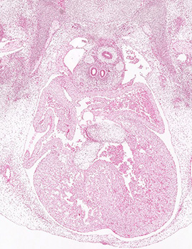 A histology section of a human embryo
