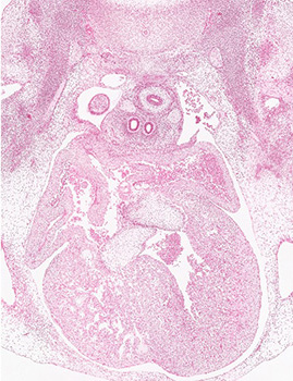 A histology section of a human embryo