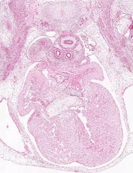 A histology section of a human embryo