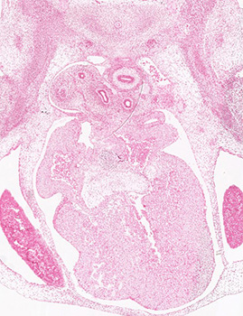 A histology section of a human embryo