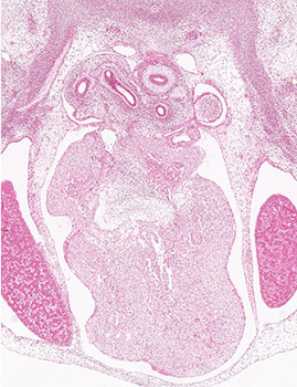 A histology section of a human embryo