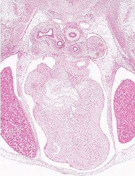 A histology section of a human embryo