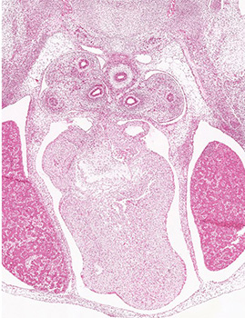 A histology section of a human embryo