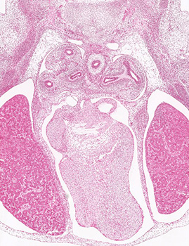 A histology section of a human embryo