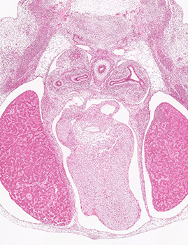 A histology section of a human embryo