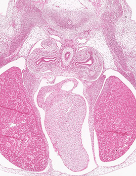 A histology section of a human embryo