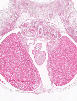 A histology section of a human embryo