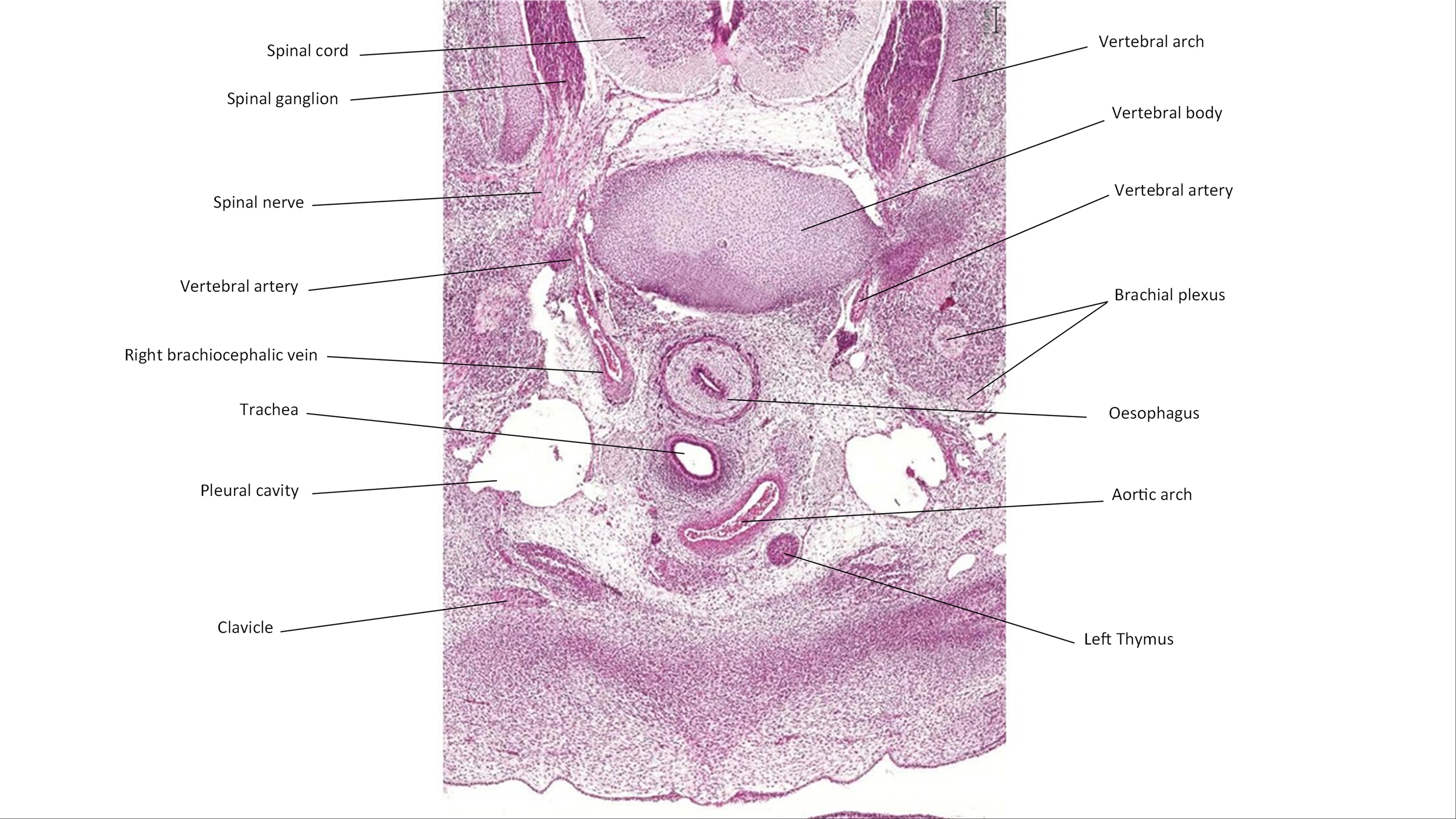 A histology section of a human embryo