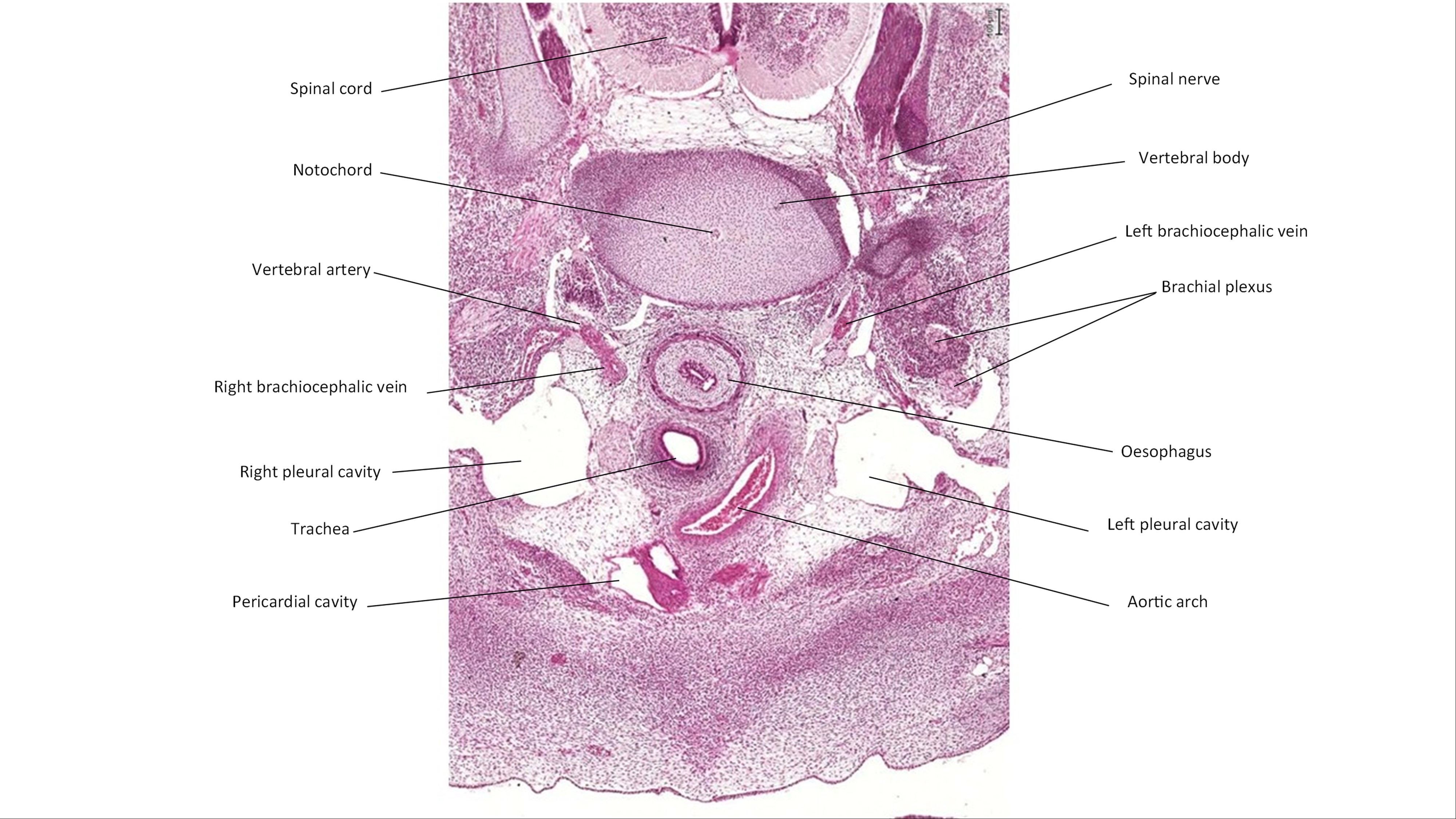 A histology section of a human embryo
