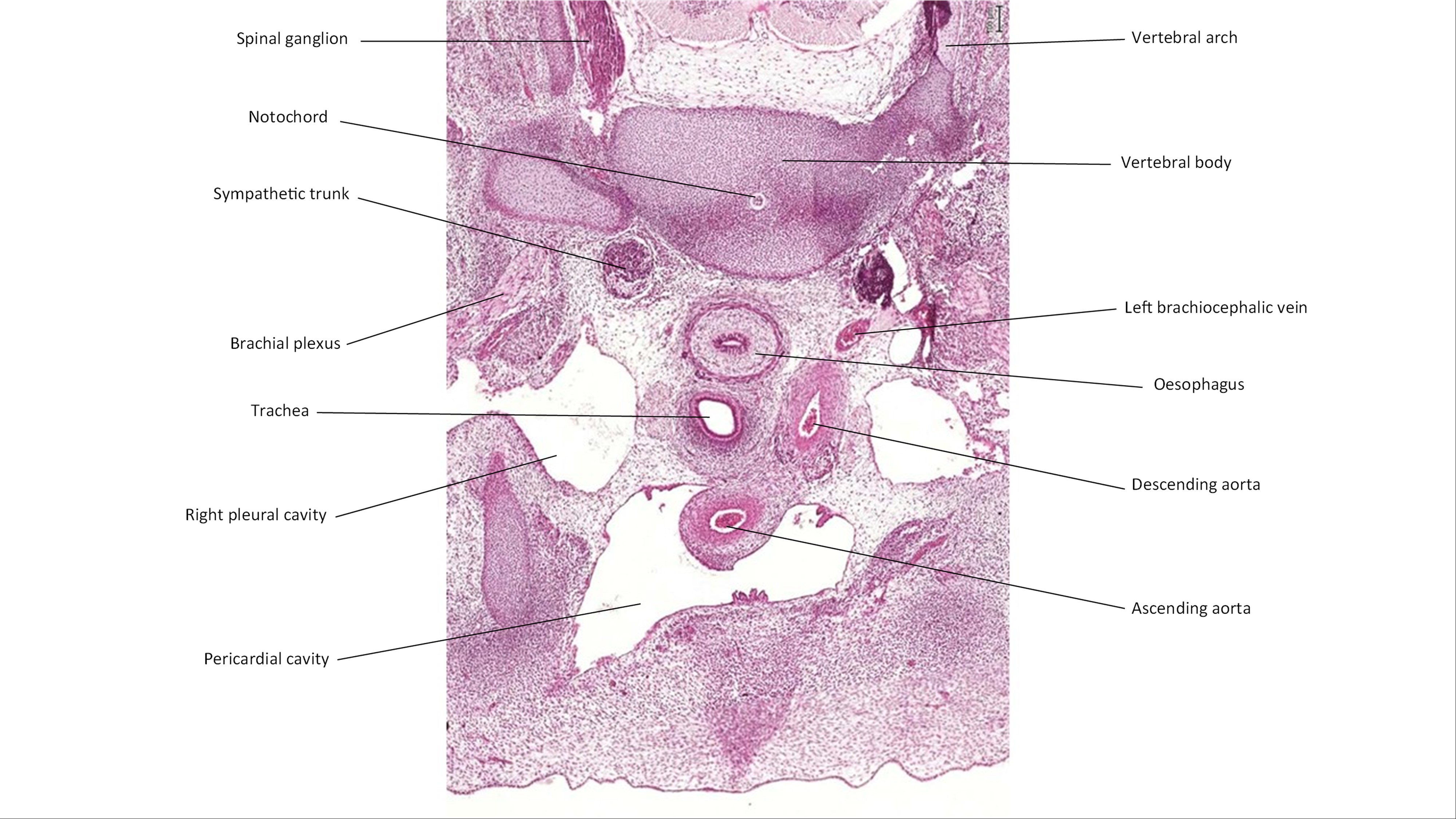 A histology section of a human embryo