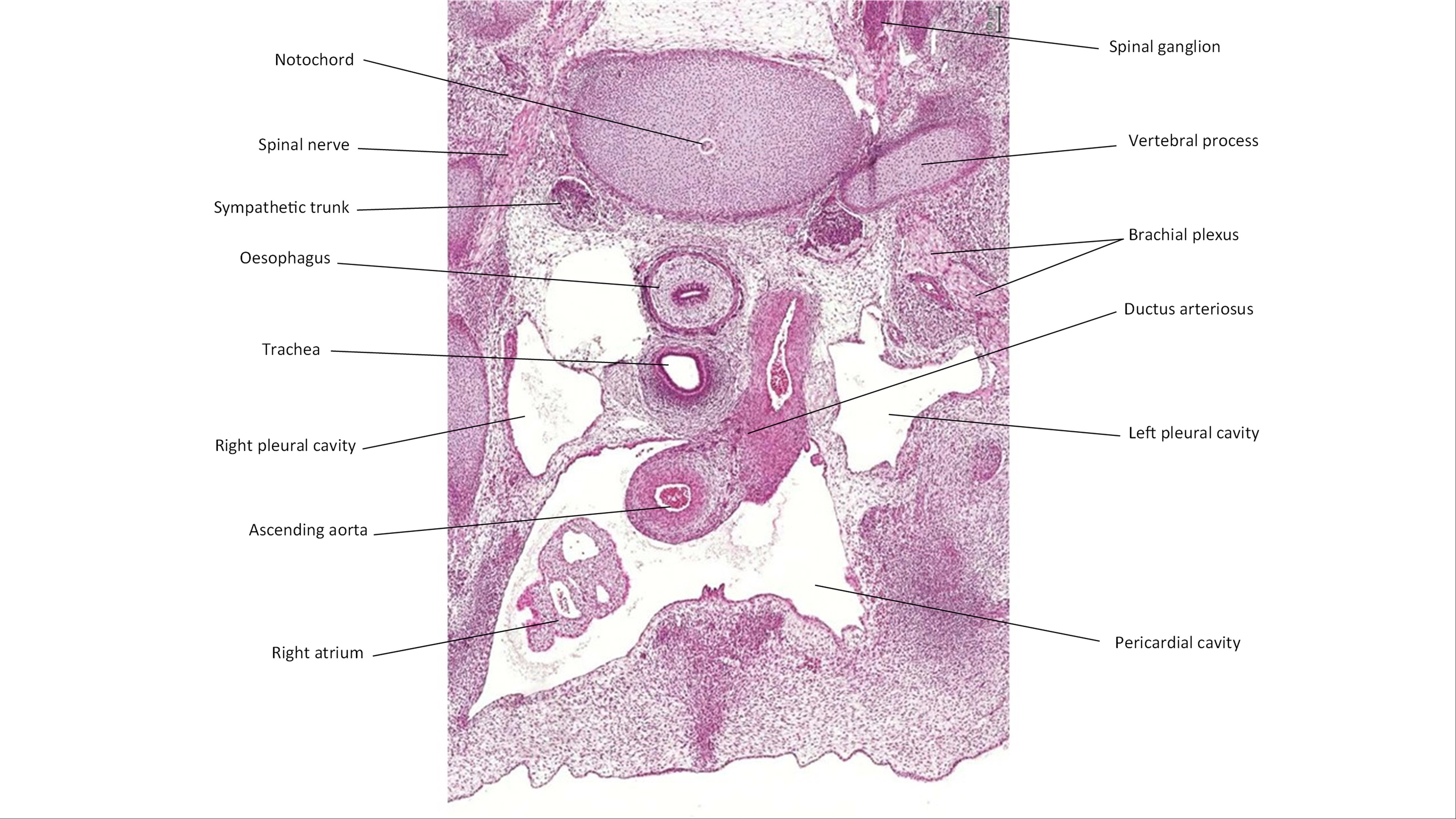 A histology section of a human embryo