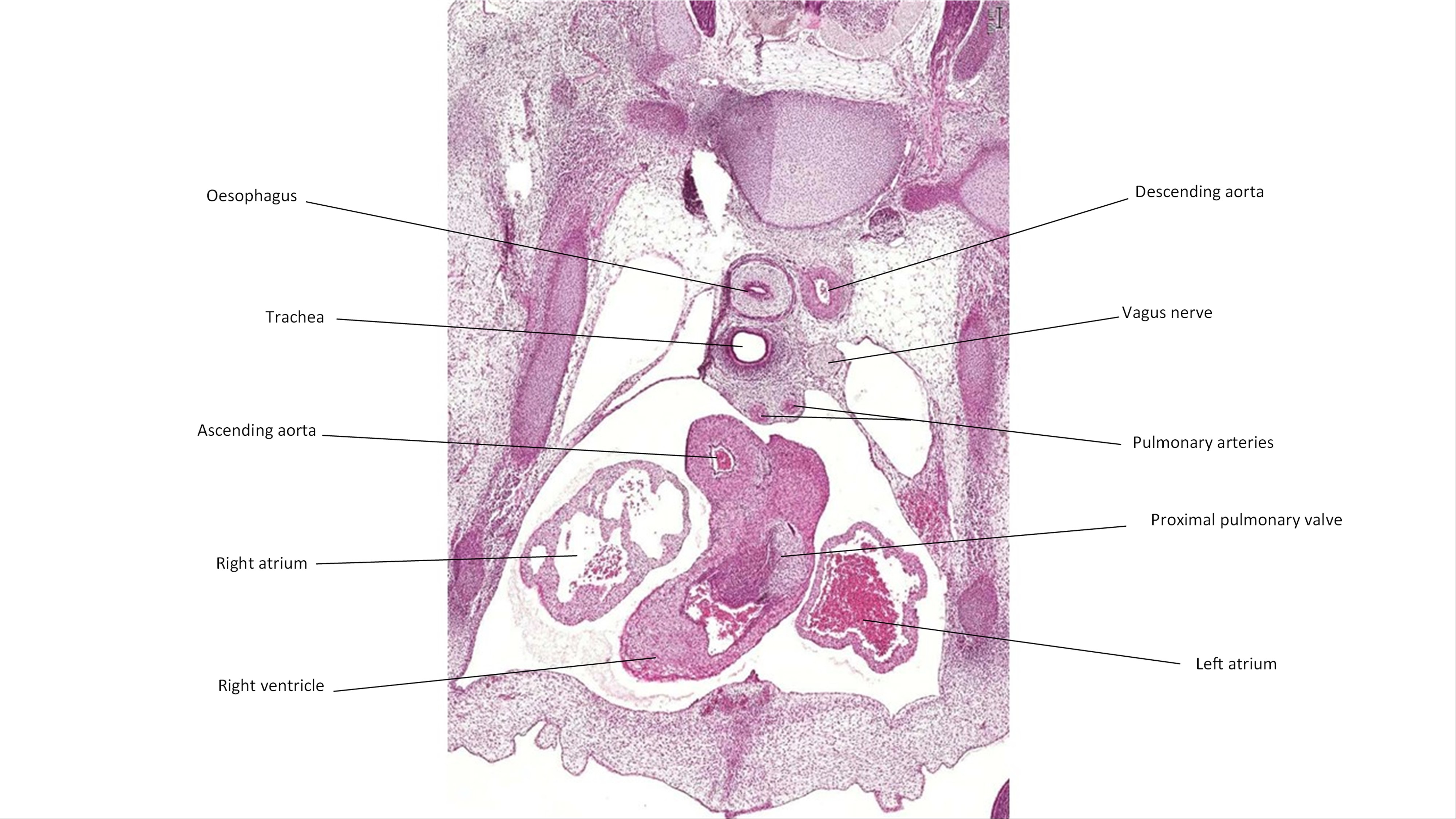 A histology section of a human embryo