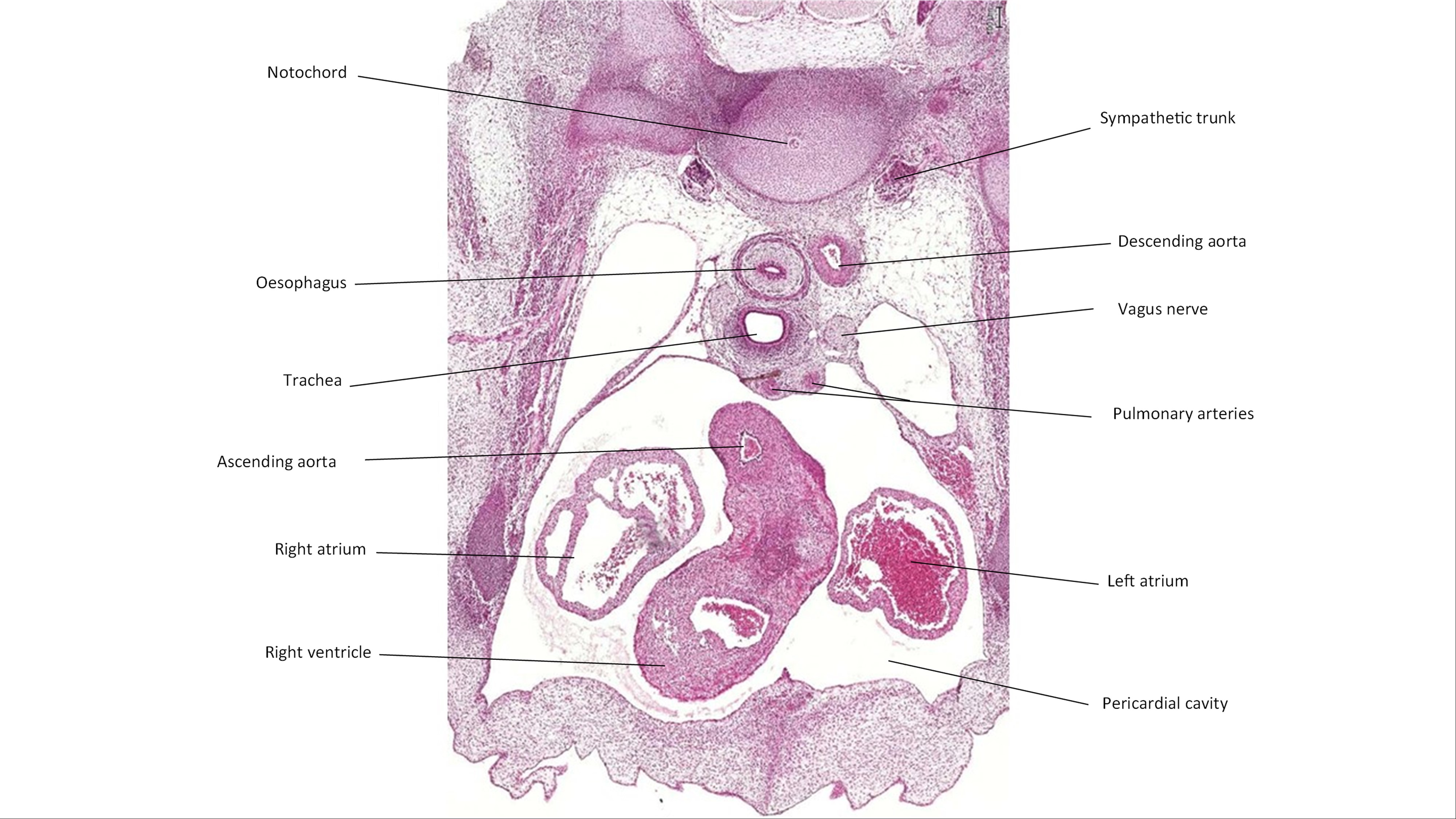 A histology section of a human embryo