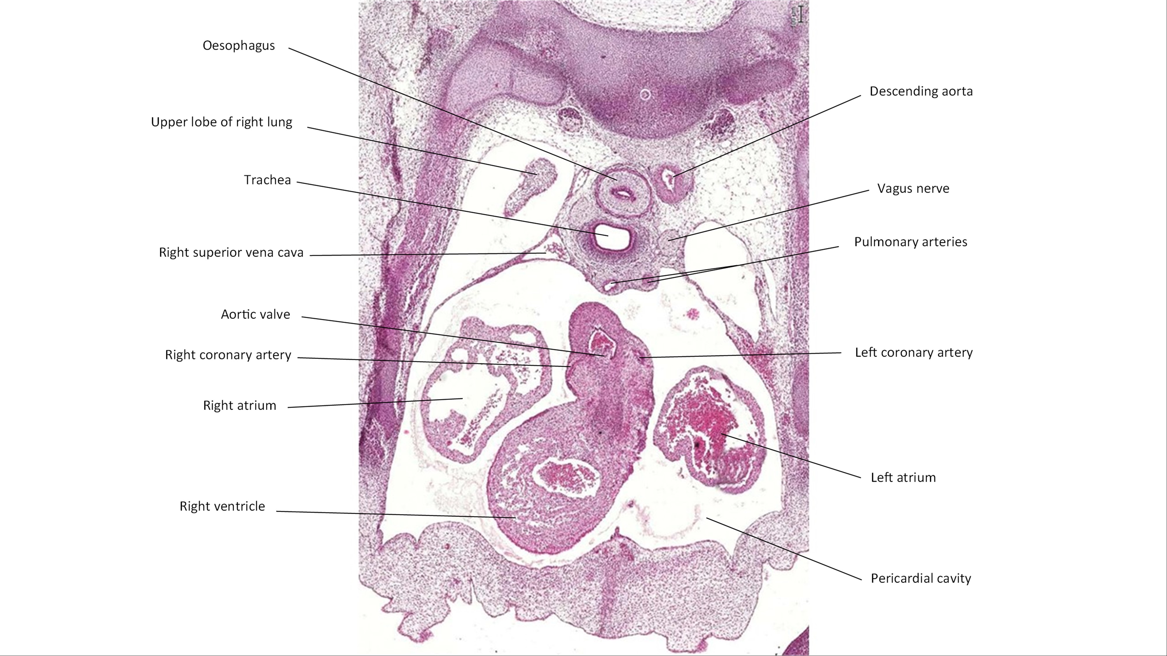 A histology section of a human embryo
