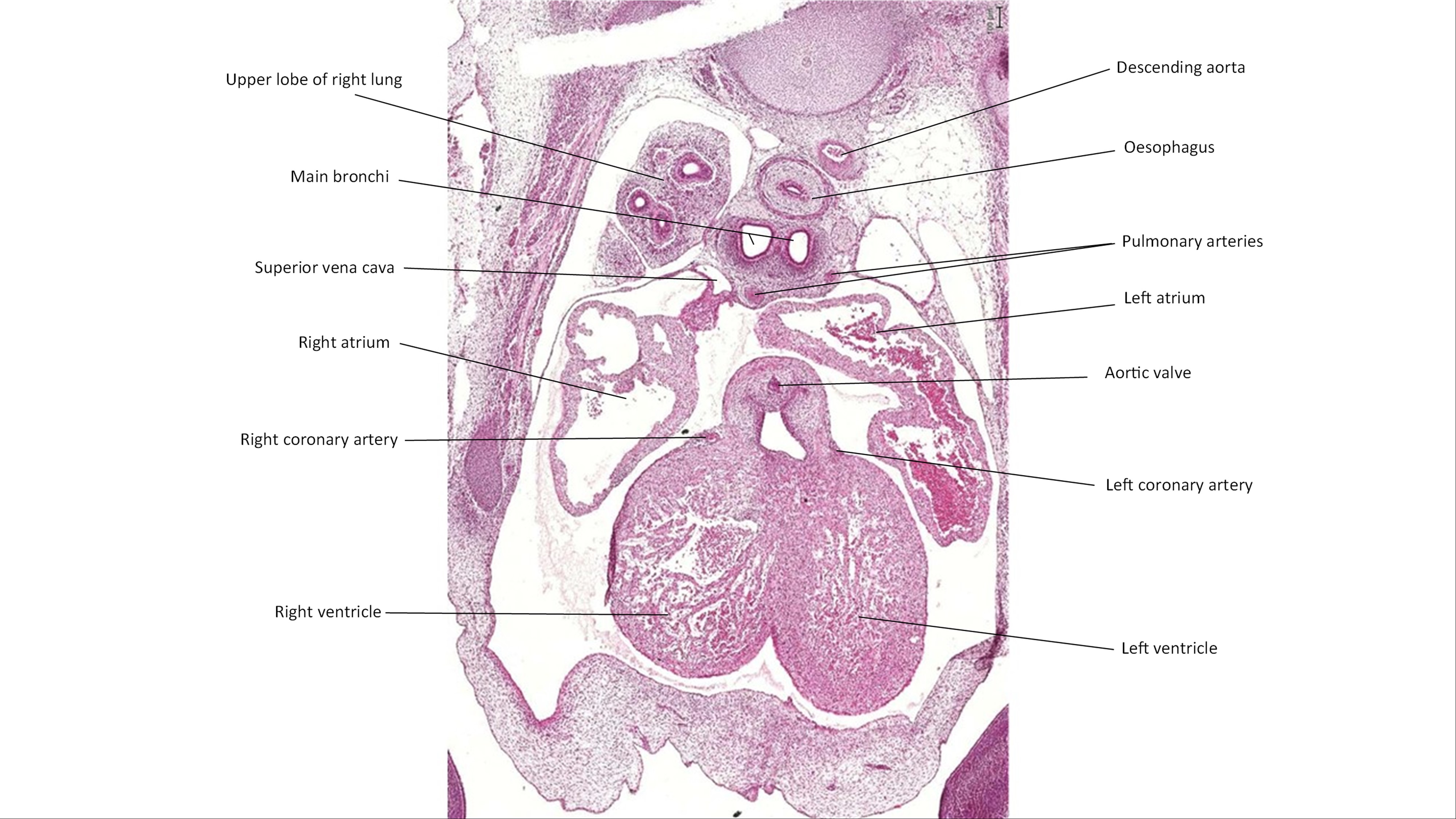 A histology section of a human embryo