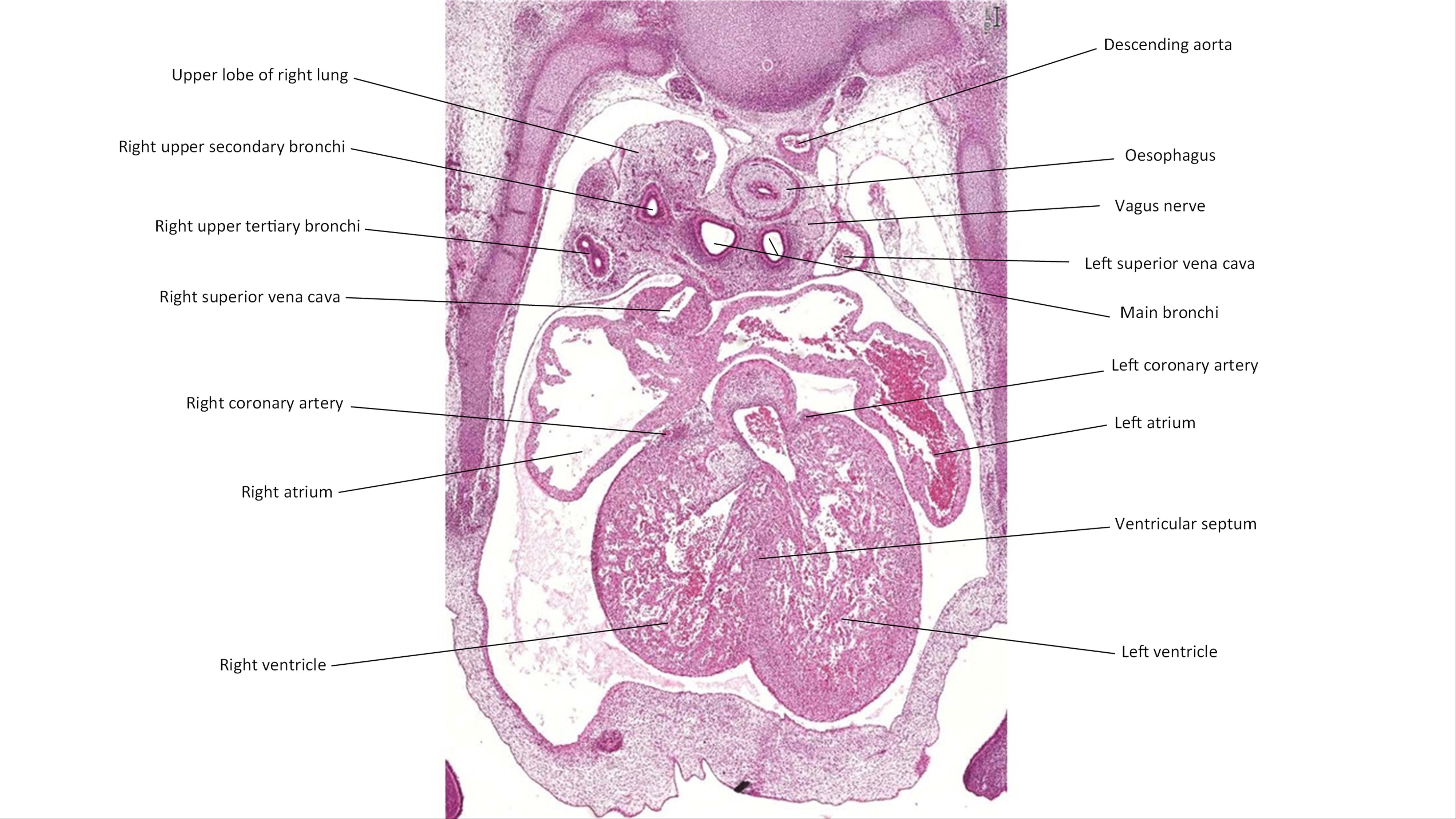 A histology section of a human embryo