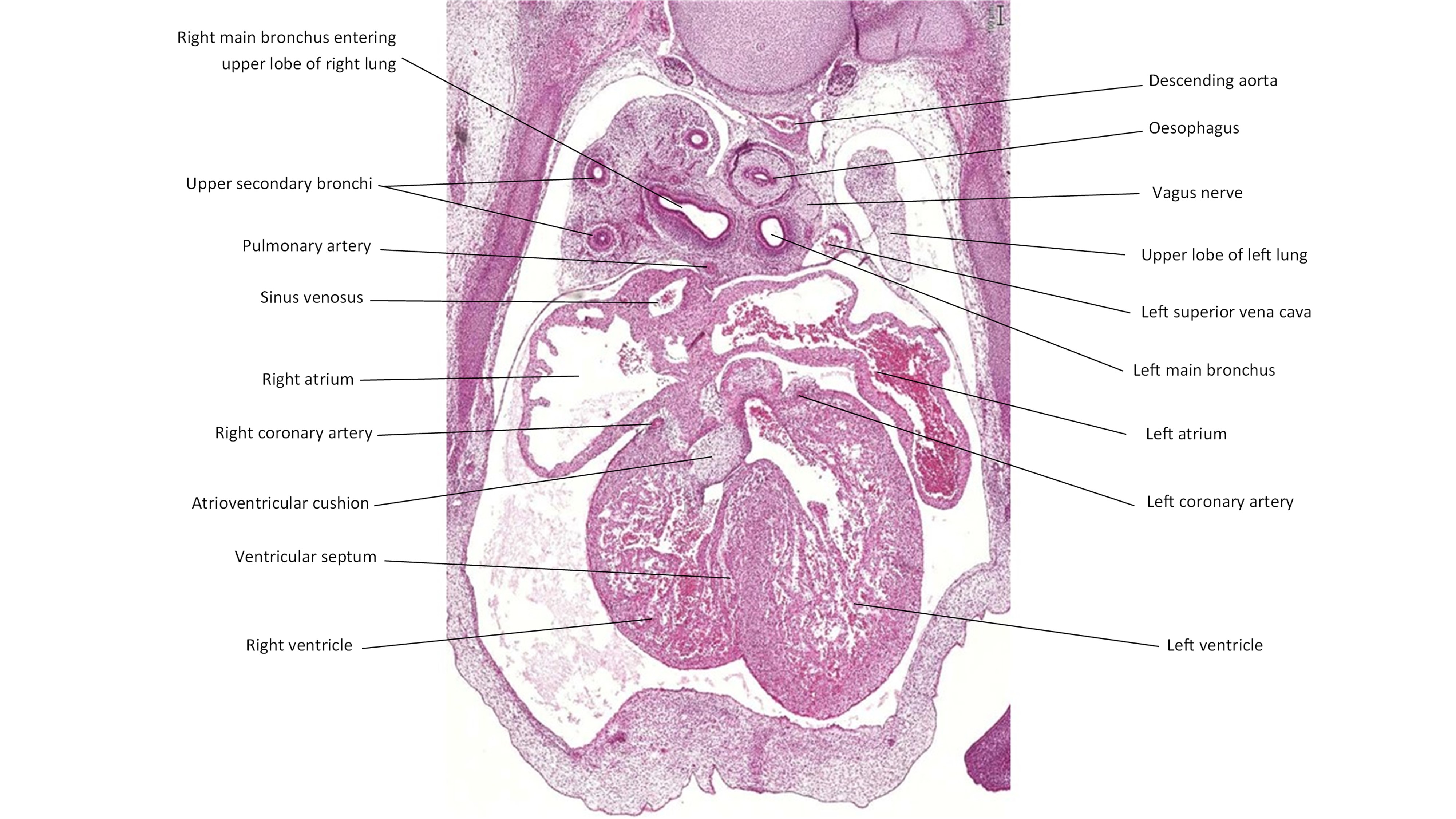 A histology section of a human embryo