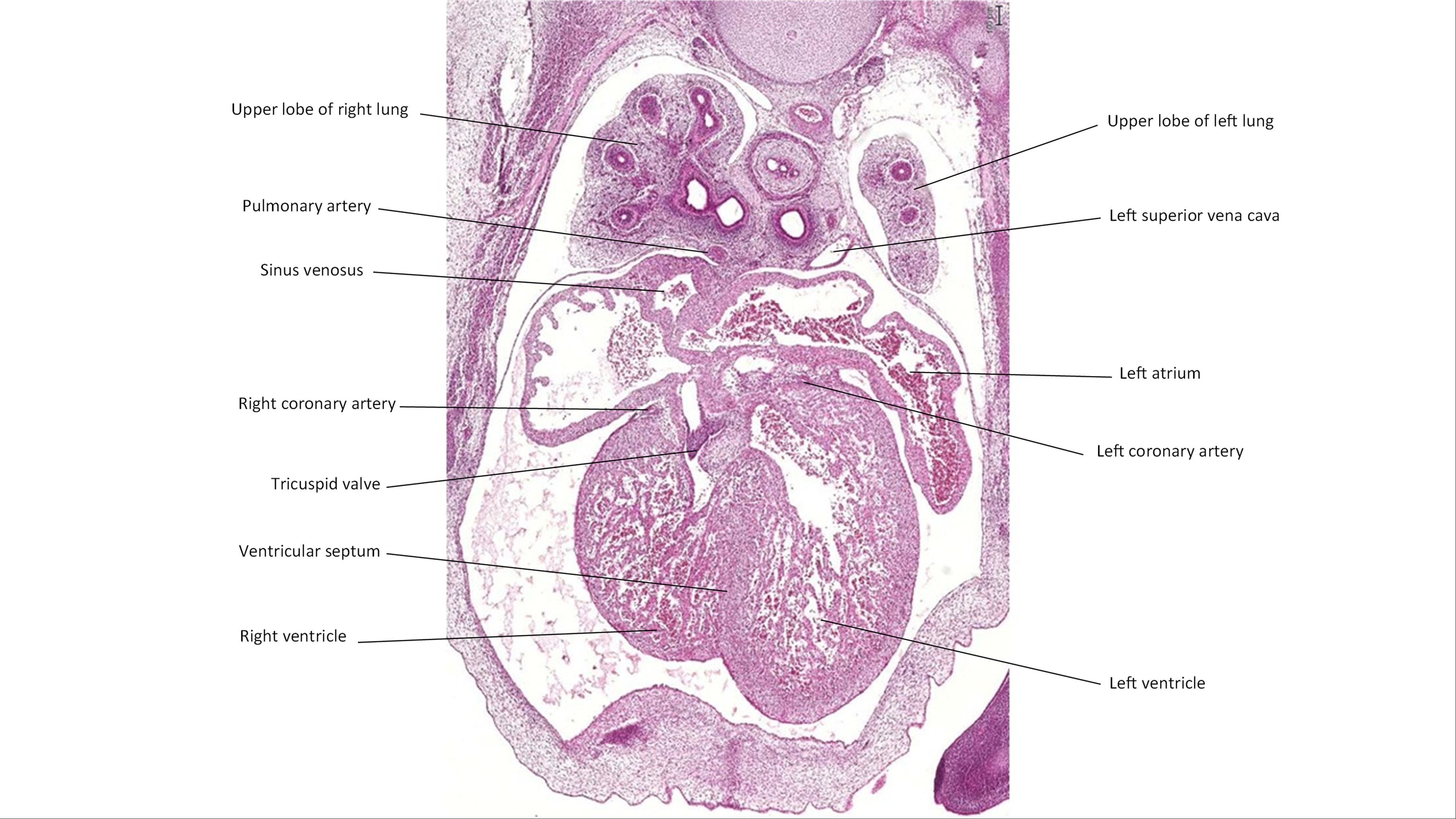 A histology section of a human embryo