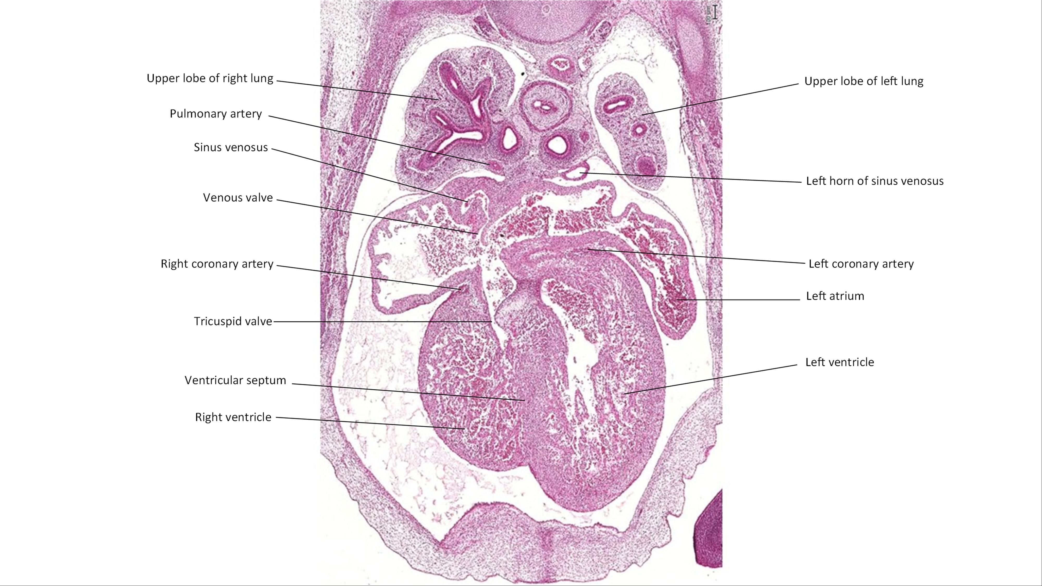 A histology section of a human embryo