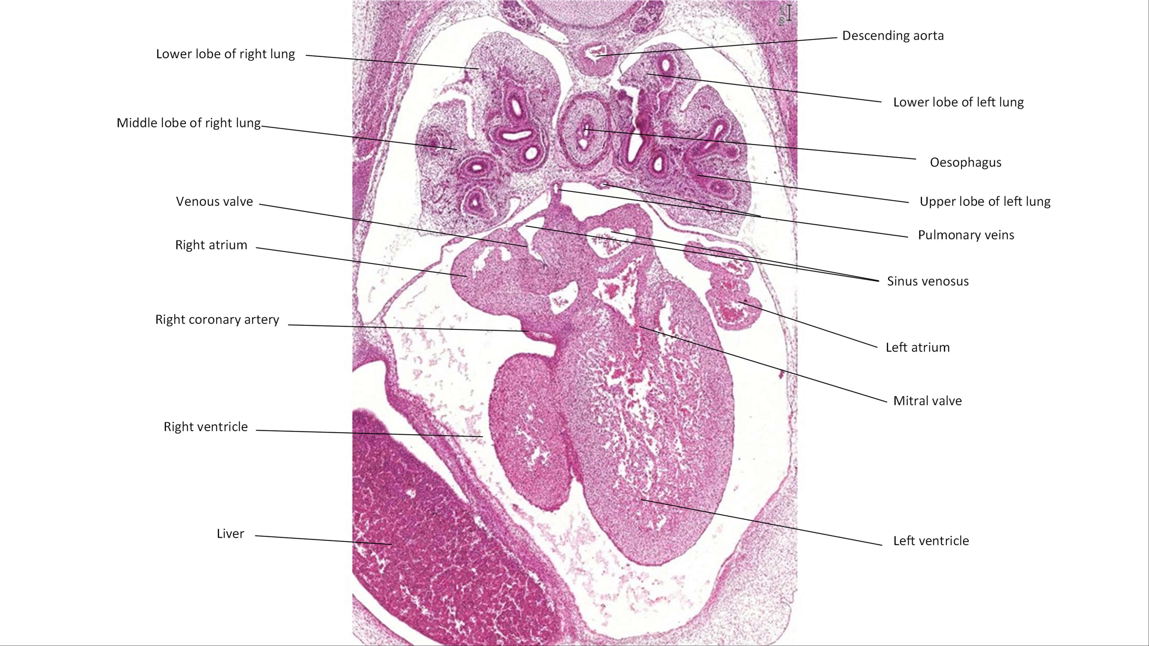 A histology section of a human embryo