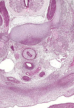 A histology section of a human embryo