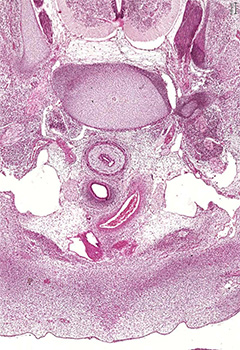 A histology section of a human embryo