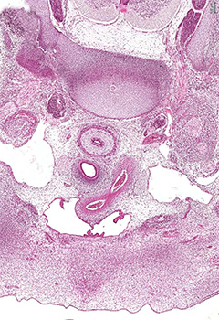 A histology section of a human embryo