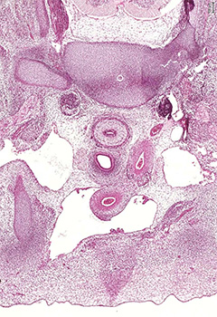 A histology section of a human embryo