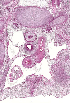 A histology section of a human embryo