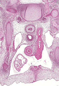 A histology section of a human embryo