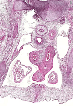 A histology section of a human embryo