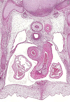 A histology section of a human embryo
