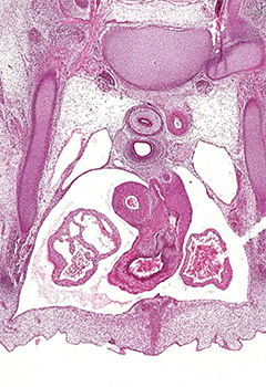 A histology section of a human embryo