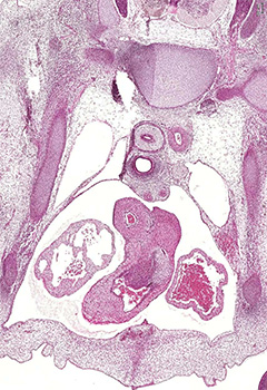 A histology section of a human embryo