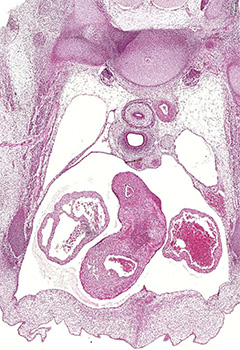 A histology section of a human embryo