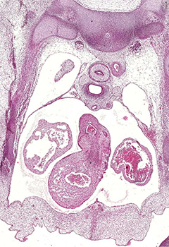 A histology section of a human embryo