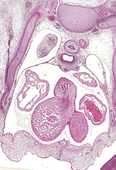 A histology section of a human embryo