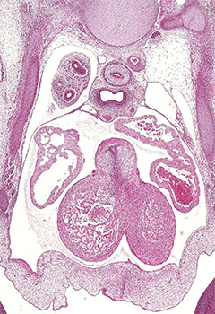 A histology section of a human embryo