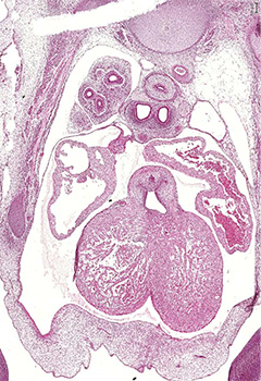 A histology section of a human embryo