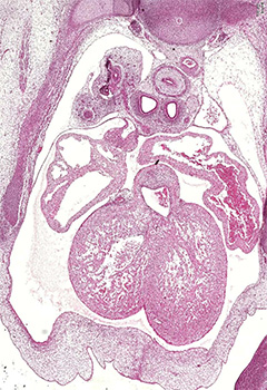 A histology section of a human embryo