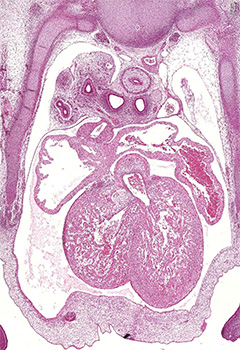 A histology section of a human embryo