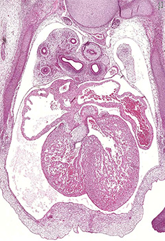 A histology section of a human embryo